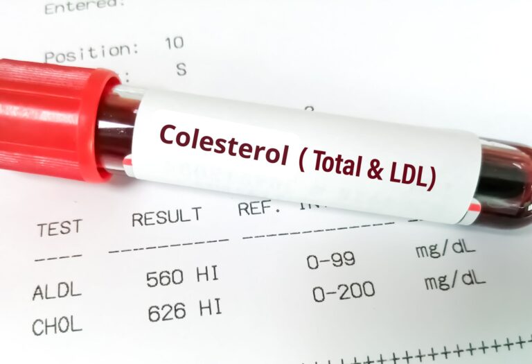 Colesterol el malo de la pelicula